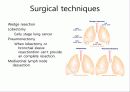 lung cancer review 15페이지