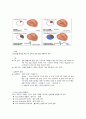 심전도(EKG, ECG) 2페이지
