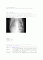 케이스 스터디 TTN(Transient Tachypnea of the Newborn) 일과성 빈호흡 7페이지