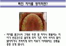 Implant(임플란트)에 대해 4페이지