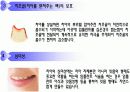 Implant(임플란트)에 대해 7페이지
