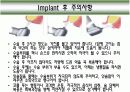 Implant(임플란트)에 대해 14페이지