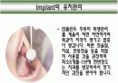 Implant(임플란트)에 대해 15페이지