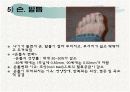 노인의 피부.감각기계 변화 13페이지