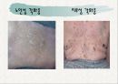 노인의 피부.감각기계 변화 23페이지