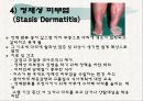 노인의 피부.감각기계 변화 24페이지