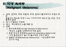 노인의 피부.감각기계 변화 26페이지