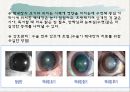 노인의 피부.감각기계 변화 56페이지