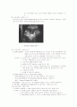 자궁근종 (Uterine Myoma)병태생리 4페이지