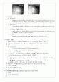 MI case 간호진단 6페이지