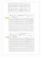 MI case 간호진단 13페이지