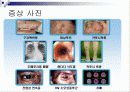 에이즈의 이해에 대한 발표자료 12페이지