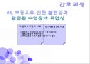 발달상 고관절 형성장애c(DDH)case study  37페이지