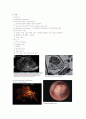 자궁근종(uterine myoma) 5페이지