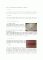 여드름과 색소침착 6페이지