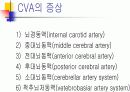 뇌졸증(중풍)의 개념 및 원인, 치료 등 5페이지