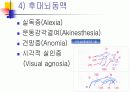 뇌졸증(중풍)의 개념 및 원인, 치료 등 9페이지