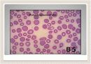 Peripheral Blood Smear 10페이지