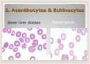 Peripheral Blood Smear 14페이지