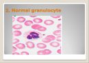 Peripheral Blood Smear 31페이지