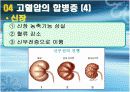 고혈압 강의 - 보건소 실습 경로당, 노인정, 보건소용 (ppt자료) 17페이지