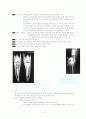 골육종(osteosarcoma)에 대하여 4페이지
