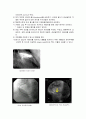CAG(coronary angiography)  5페이지