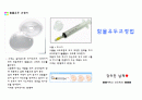 함몰유두교정법 2페이지