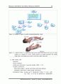 [물리치료] Muscular Dystrophy and Spinal Muscular Atrophy 근육성이영양증과 척수의 근육퇴행성 13페이지