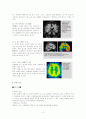 간질 case study 4페이지