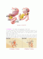 [간호학]위절제수술의 종류와 방법 3페이지