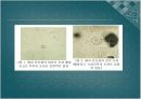 Swine Coccidiosis (돼지 콕시듐증)에 관한 팀 프로젝트(특A++)// 수의학과 학생이 직접 제작 10페이지