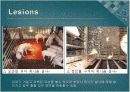 Swine Coccidiosis (돼지 콕시듐증)에 관한 팀 프로젝트(특A++)// 수의학과 학생이 직접 제작 17페이지