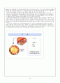 Liver cell carcinoma 간세포암 case study 8페이지