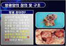 방광암 bladder cancer 3페이지
