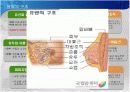 breast cancer 유방암 3페이지
