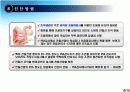 ProstateCancer 전립선암 19페이지