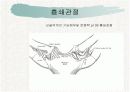 견관절과 견갑대 11페이지
