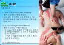 제 XI.뇌신경 Accessory nerve 25페이지