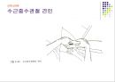 손목관절과 손 58페이지