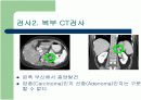 Cushing Syndrome PBL 발표자료 12페이지