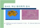 Cushing Syndrome PBL 발표자료 13페이지