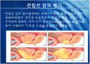 Prostatic Cancer 전립선암.ppt 11페이지