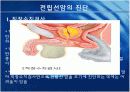 Prostatic Cancer 전립선암.ppt 13페이지