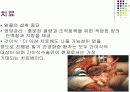 간, 담도, 췌장 18페이지