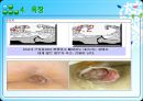 피부기계 22페이지