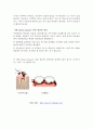 치면세균막(치태,덴탈플러그) 2페이지