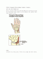 TFCC injury(삼각 섬유 연골 복합체 손상) 1페이지