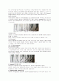 치아 삭제용 기구  10페이지