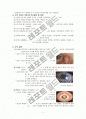 눈의 구조와 기능 및 질환 - 병리학 3페이지